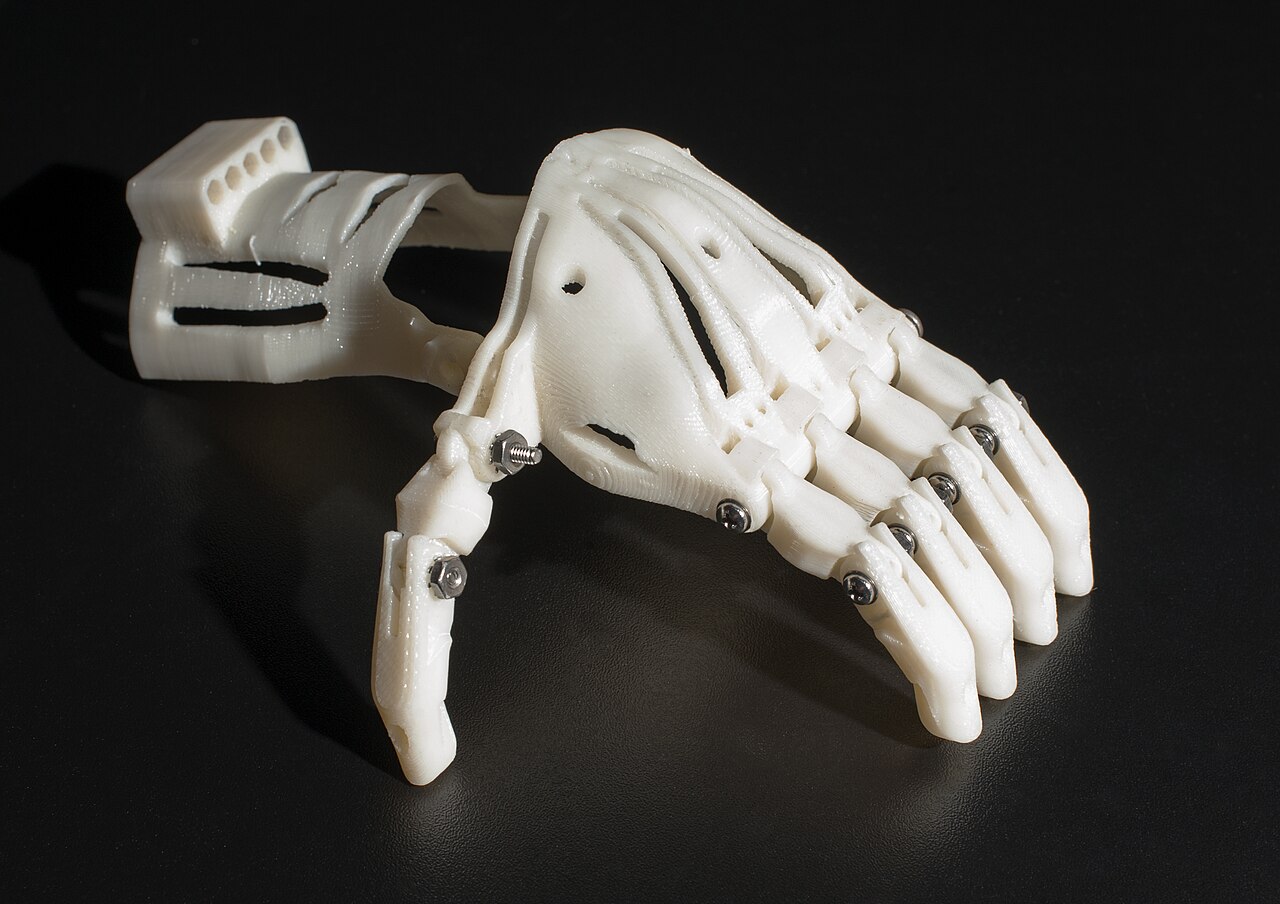 Italian Researchers Use Field-Driven Lattice Design to Cut Prosthetic Socket Weight by 25%