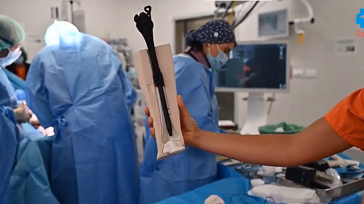 Madrid Hospital Creates First 3D-Printed Bone Metamaterial Prosthesis, Saves Patient's Leg