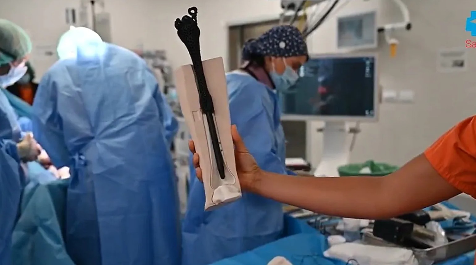 Madrid Hospital Saves a Leg With the First 3D-Printed Titanium Metamaterial Prosthesis