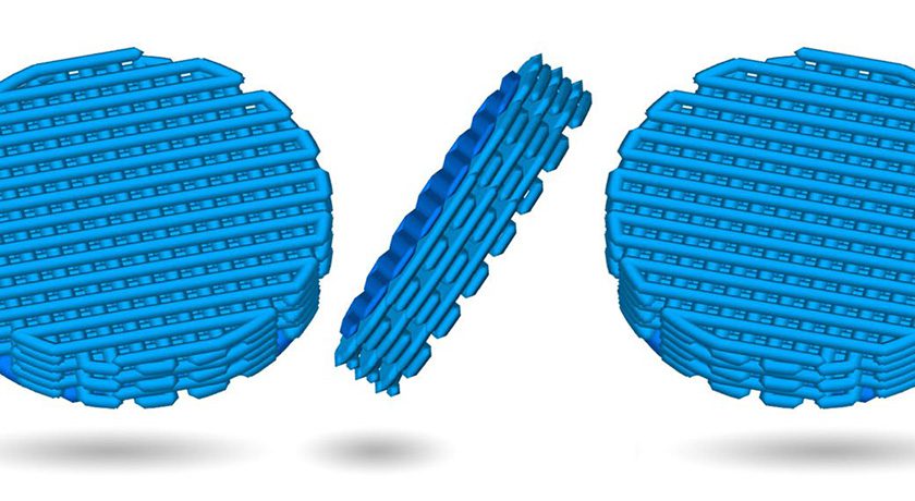 First Patient Treated With 3D-Printed Knee Cartilage Implant in Human Trial