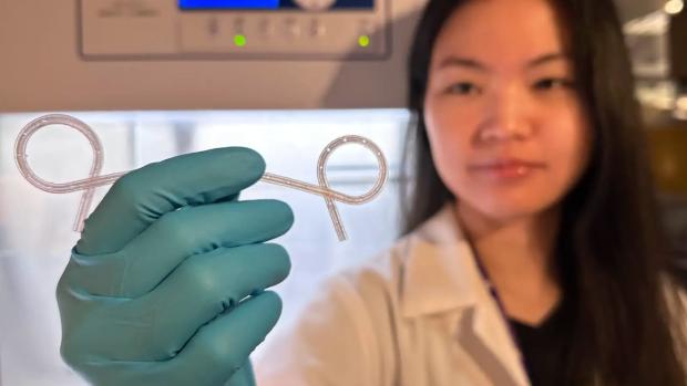 NYU's 3D-Printed Lily Stent Could Make Gastric Leak Recovery Less Miserable