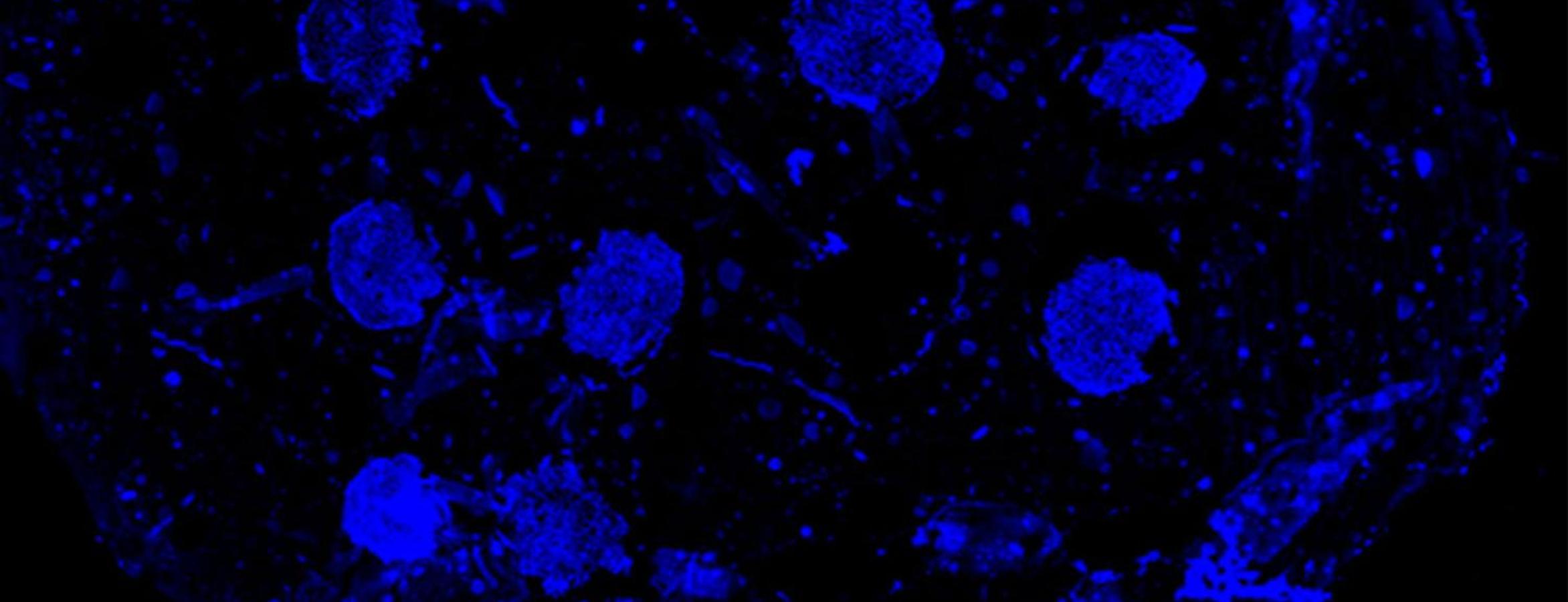 Penn State Team 3D Prints Bone Tissue That Grows Its Own Blood Vessels