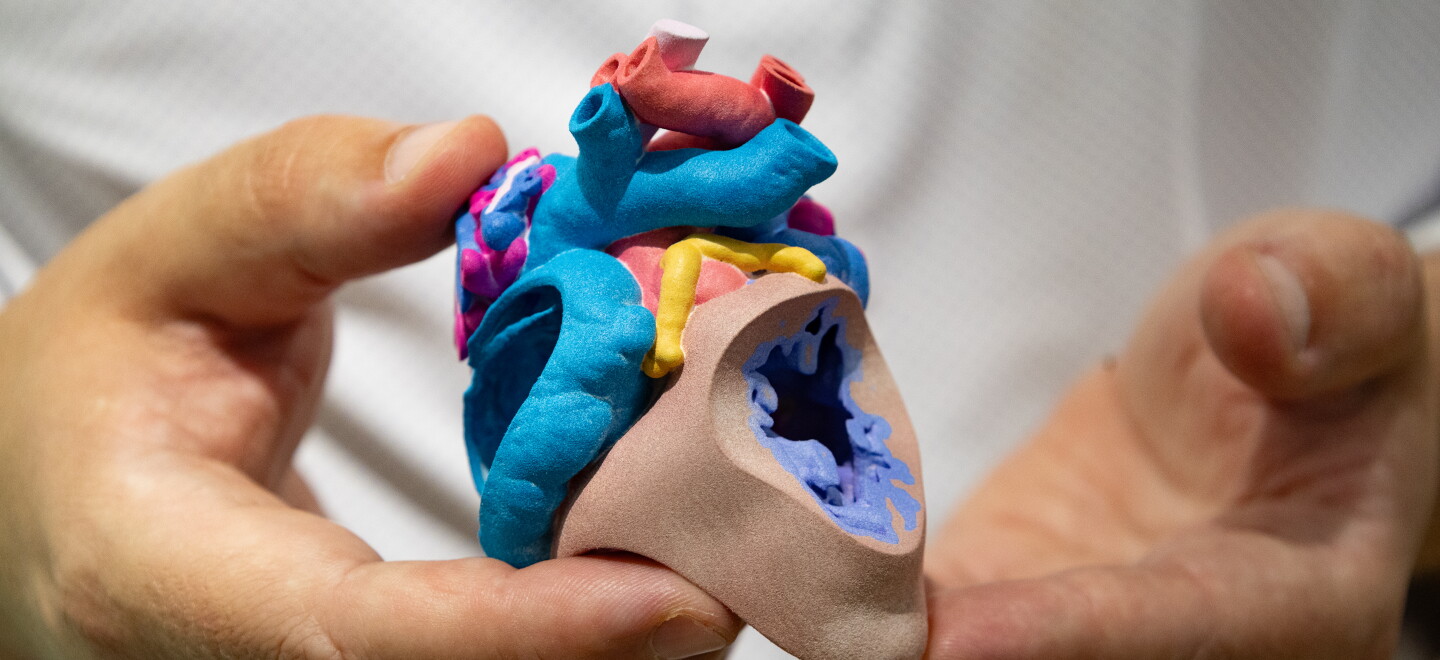Rady Children's 3D Lab Prints Patient Models to Help Surgeons Plan Complex Cases