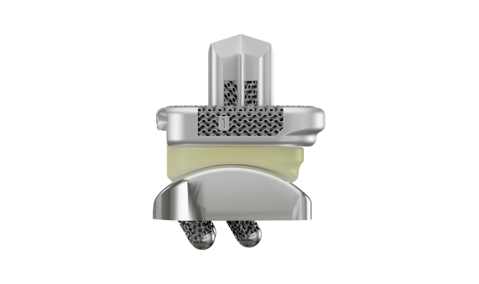 restor3d Launches MyFit Patient Portal for 3D-Printed Orthopaedic Implants